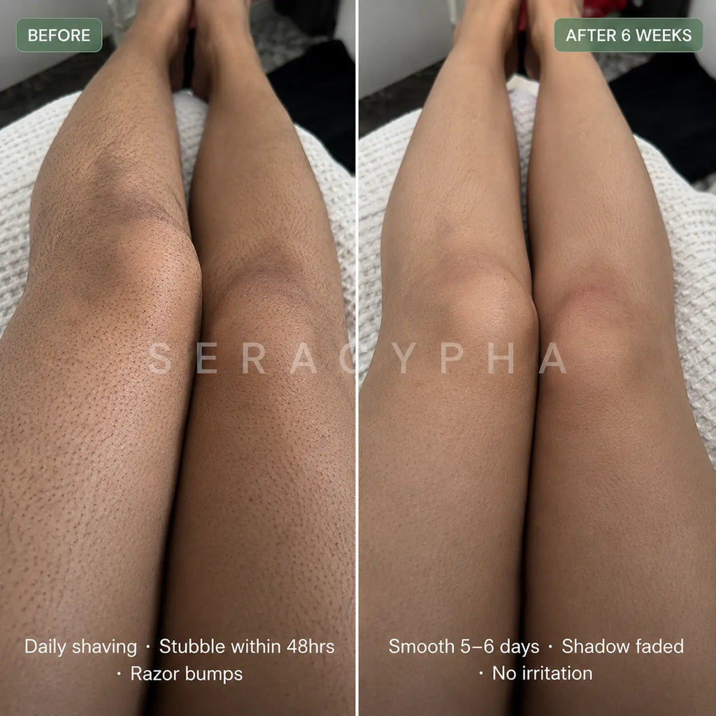 Seracypha™ Cyperus Rotundus Skin Serum - Stop Unwanted Hair Growth Naturally