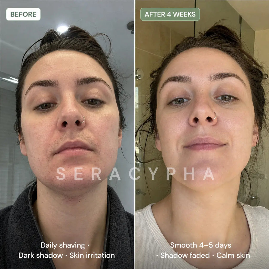 Seracypha™ Cyperus Rotundus Skin Serum - Stop Unwanted Hair Growth Naturally